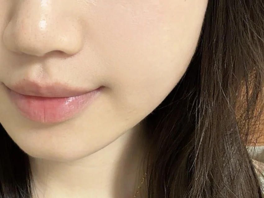 快30岁的皮肤状态嘎嘎乱杀