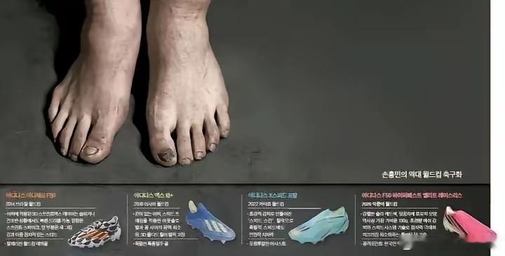韩媒晒出孙兴慜伤痕累累的脚部照片，属实让人震撼。韩国《中央日报》公开的...
