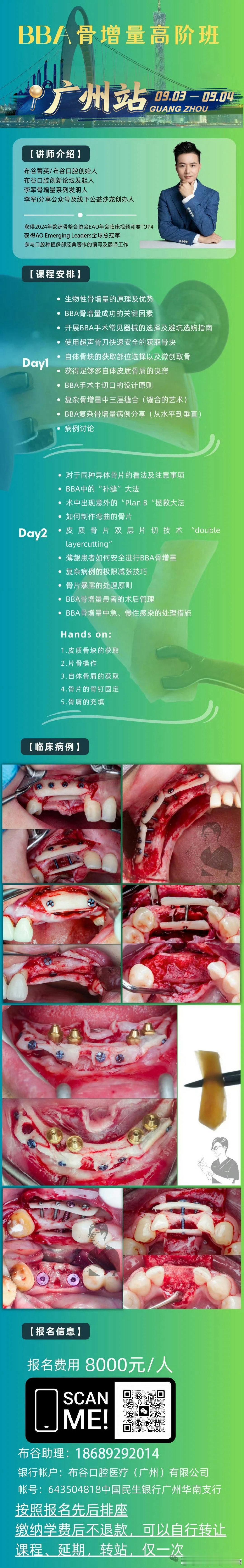 一例骨柱加军牌盾牌钉  原位加远中取自体骨加骨粉1比1 做sticky bone  颊舌侧减张缝合  4周后伤口愈合良好  可预期骨增量​
