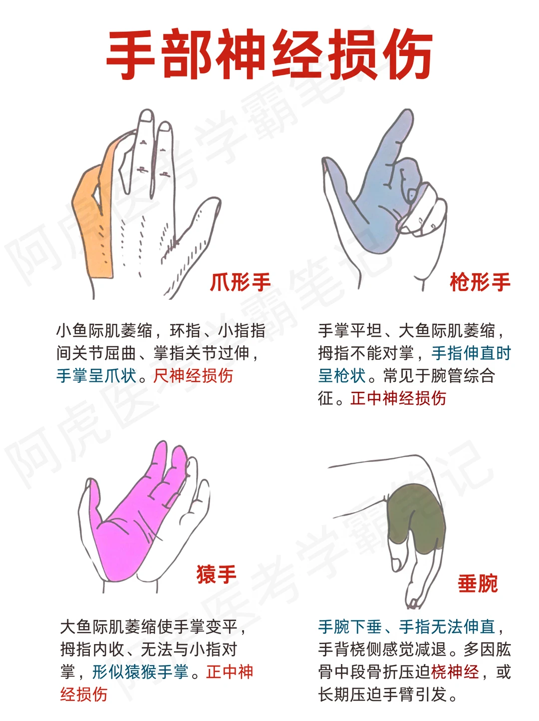 阿虎医考笔记📒手部神经损伤速记❤️