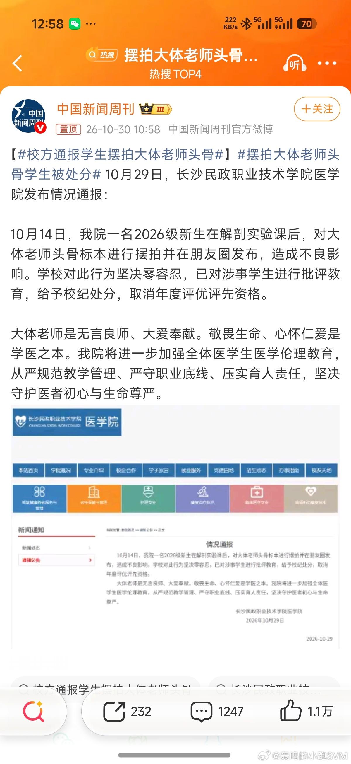 #校方通报学生摆拍大体老师头骨# 有些人会对此不以为然，觉得＂又怎么了，没有伤害谁啊＂，关键在于如果一个人对值得尊敬的事物没有敬畏之心，你就无法确定他在未来某个关键时刻会掉多大的链子。解构英雄并且玩笑化的事情也是如此，一次玩笑二次玩笑，大家会偏离＂尊重＂的认知，久而久之就是世风日下 ​