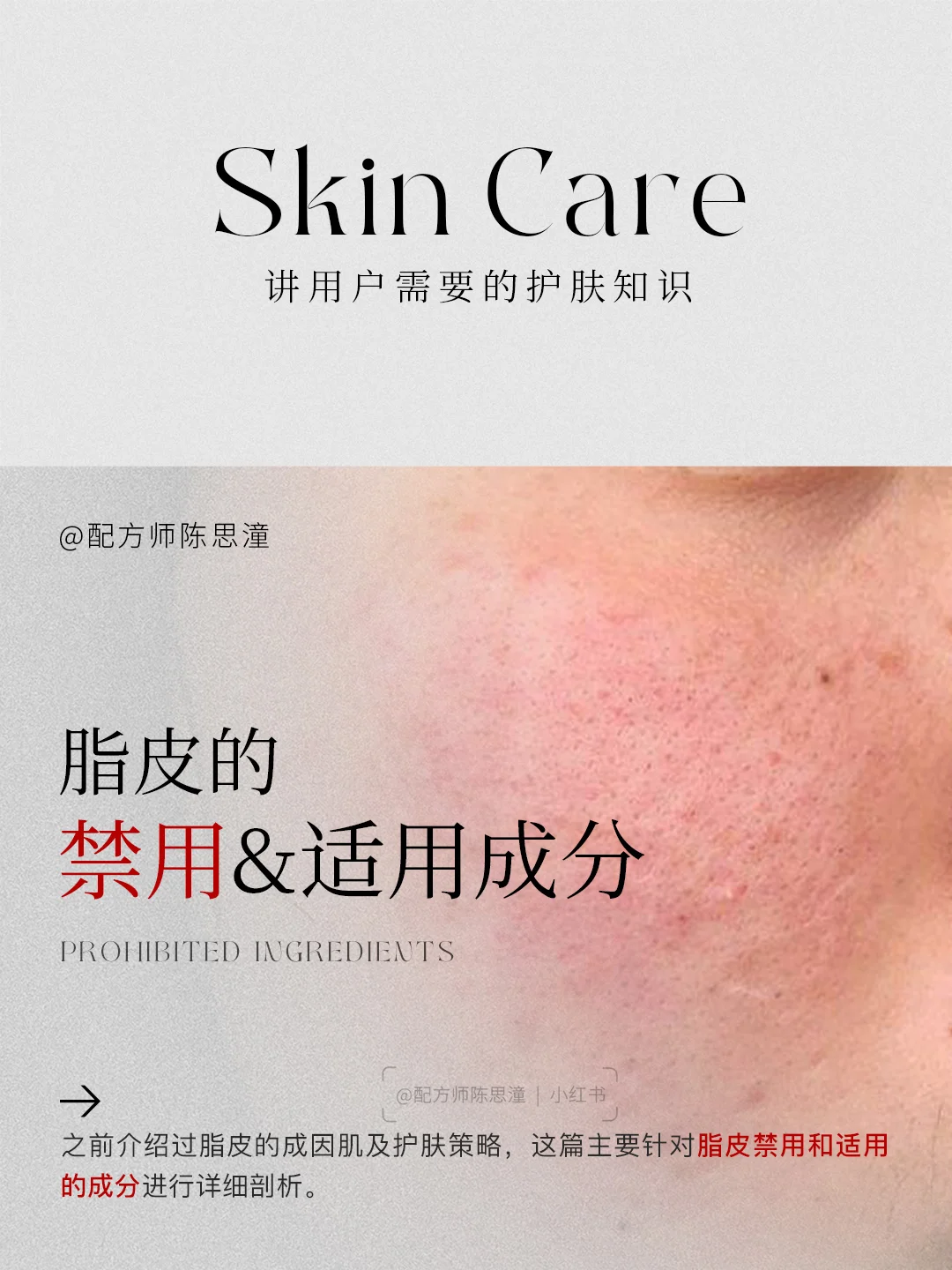 护肤知识｜脂皮的禁用&适用成分