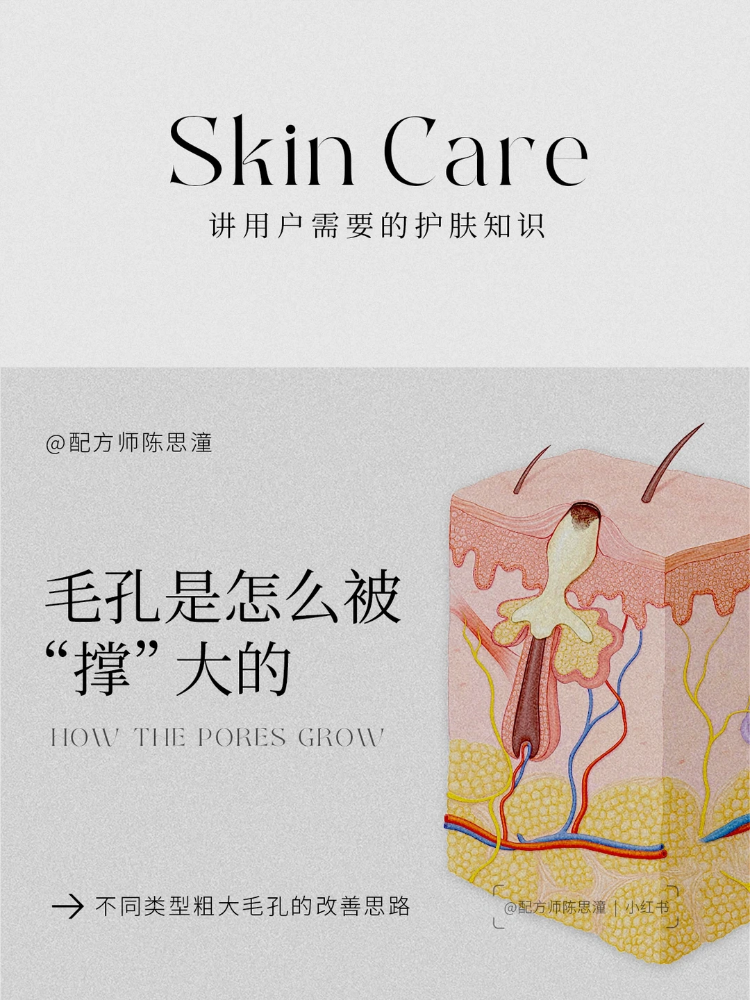 护肤知识｜毛孔是怎么被“撑”大的