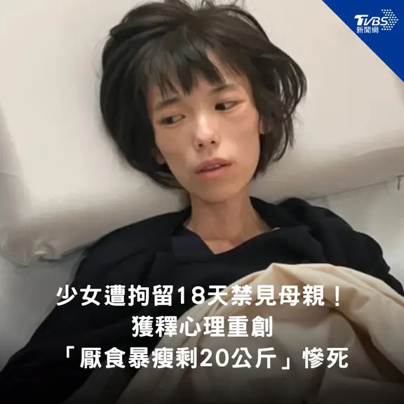 台媒：日本兵库县一名16岁少女，因在母亲经营的残疾人照护机构内发生肢体冲突，遭警方拘留18天，最终未被起诉。
	
拘留期间她被禁止与母亲见面，精神严重受创并停止进食。获释后被诊断出创伤后压力症候群（PTSD），此后进食困难持续恶化，于获释约5个月后因重度营养不良导致器官衰竭身亡，死时体重仅约20公斤，相当于6岁女童的平均体重。
	
岛民：日本一直是很噁心的民族，過度的乾淨，過度的禮貌，過度的冷漠，就是一種心理變態。