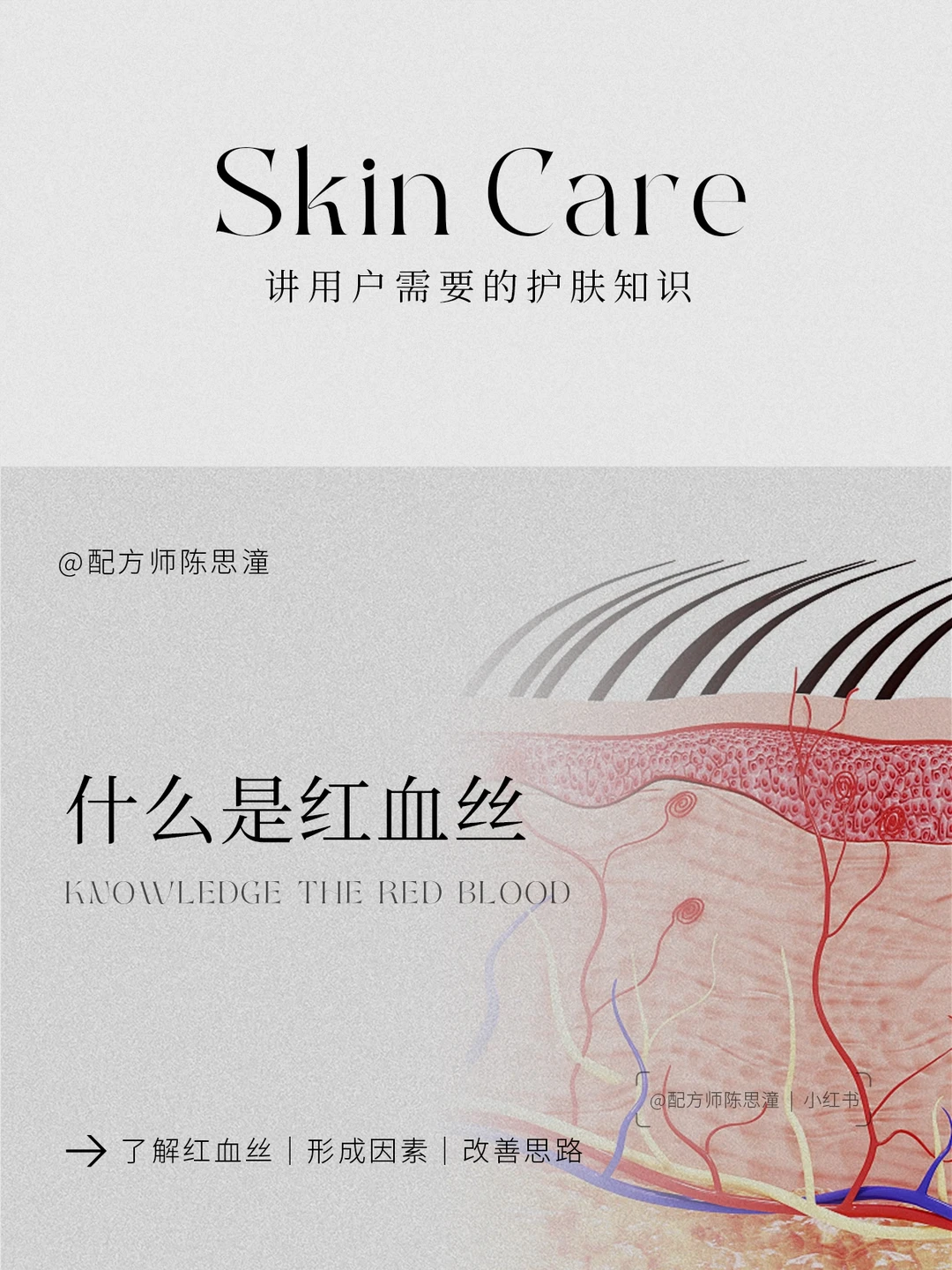 护肤知识｜什么是红血丝，如何改善？