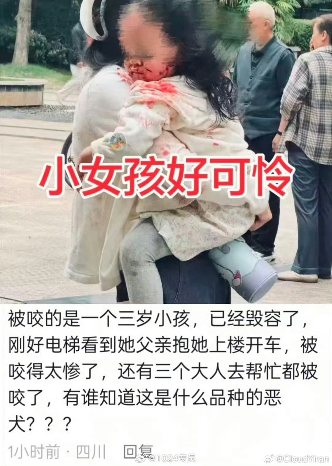 #恶犬再闯大祸孩子受伤严重#烈性犬出门应该戴嘴套啊，这么丑又凶的狗养它的心态是什么。 ​