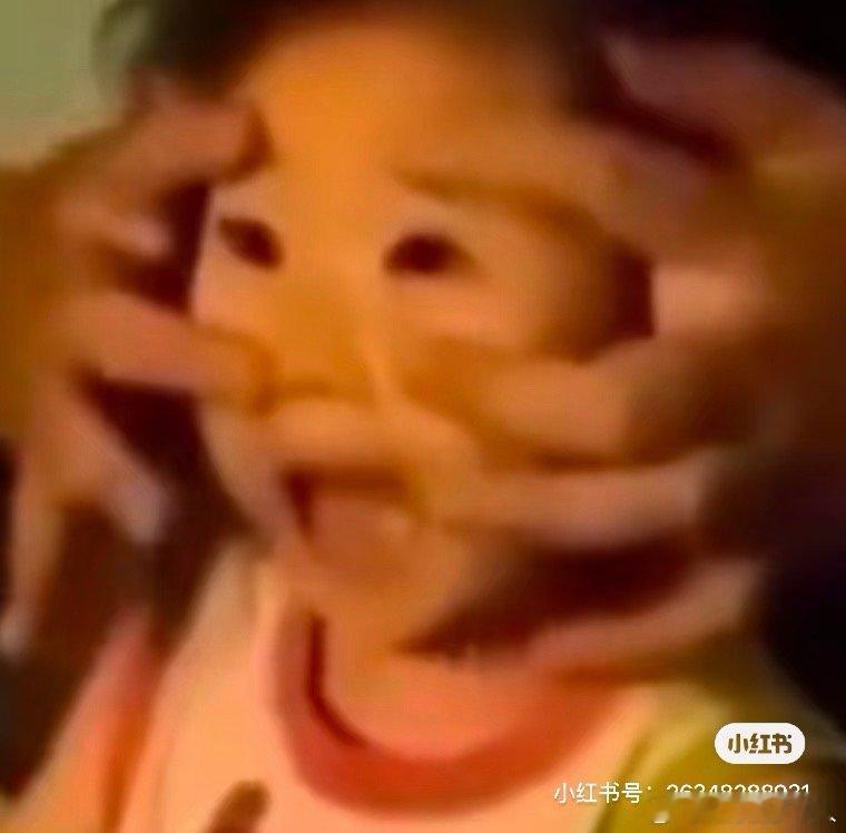 怀疑昨天的遗体太吓人了，给我同事干出PTSD了，今天只要一出车，他就跟我讲那个尸体的死状。“我们把人拖出来的时候，人往外拖了，但是头盖骨被压着留在原处，打开了。”“脑仁露出来了，现场没有血，但后来才发现是被她身下的木屑堆吸饱了。”“那个头盖骨就像那种口香糖罐头盖子，只有一点后颈部分连着。”“不知道该把人再推回去把脑子关好，还是就这样做心电图，最后拿了块布把头盖住。”……只要一出车，他就开始说，一出车，他就开始说，不断的丰富补充细节，从早上到现在的每一趟都……