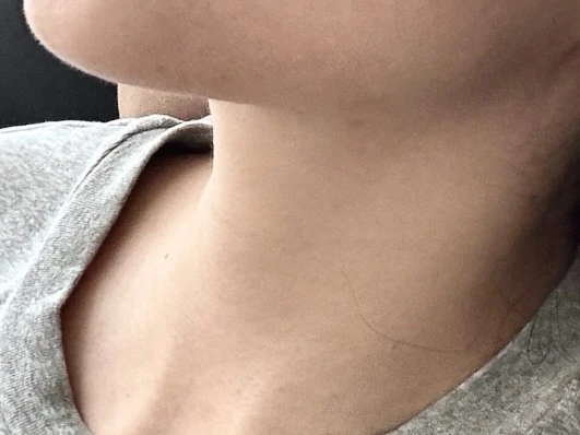 强推一个丹麦的颈纹溶解剂