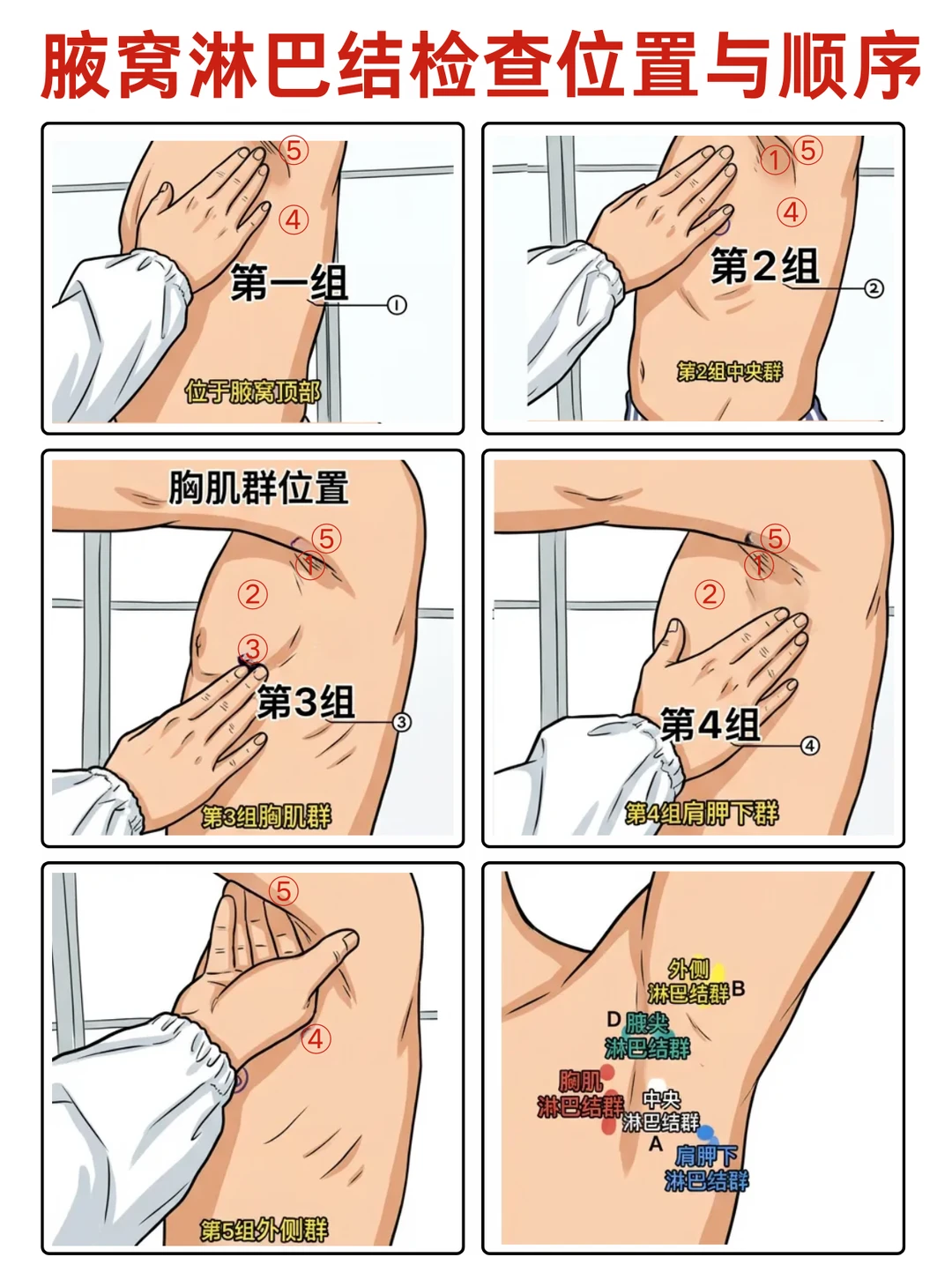 阿虎医考执医技能笔记📚|淋巴结体查👆