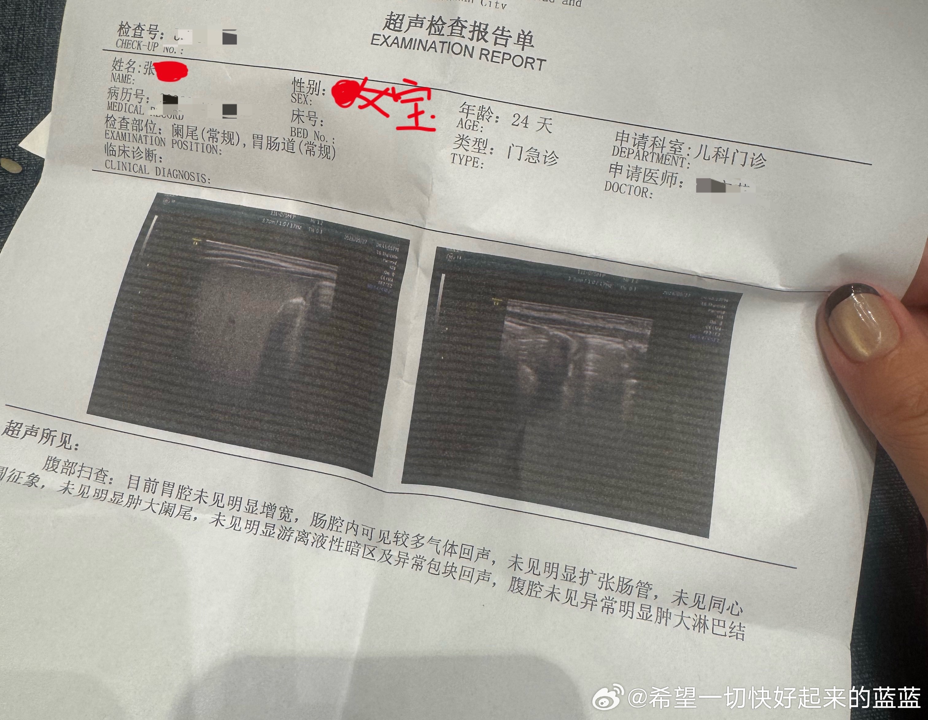 是的 其实鼠是一支女宝我为了让大家开心逗大家笑才说自己是男宝妈的[挤眼][挤眼][挤眼]怎么样 感动吗 ​​​