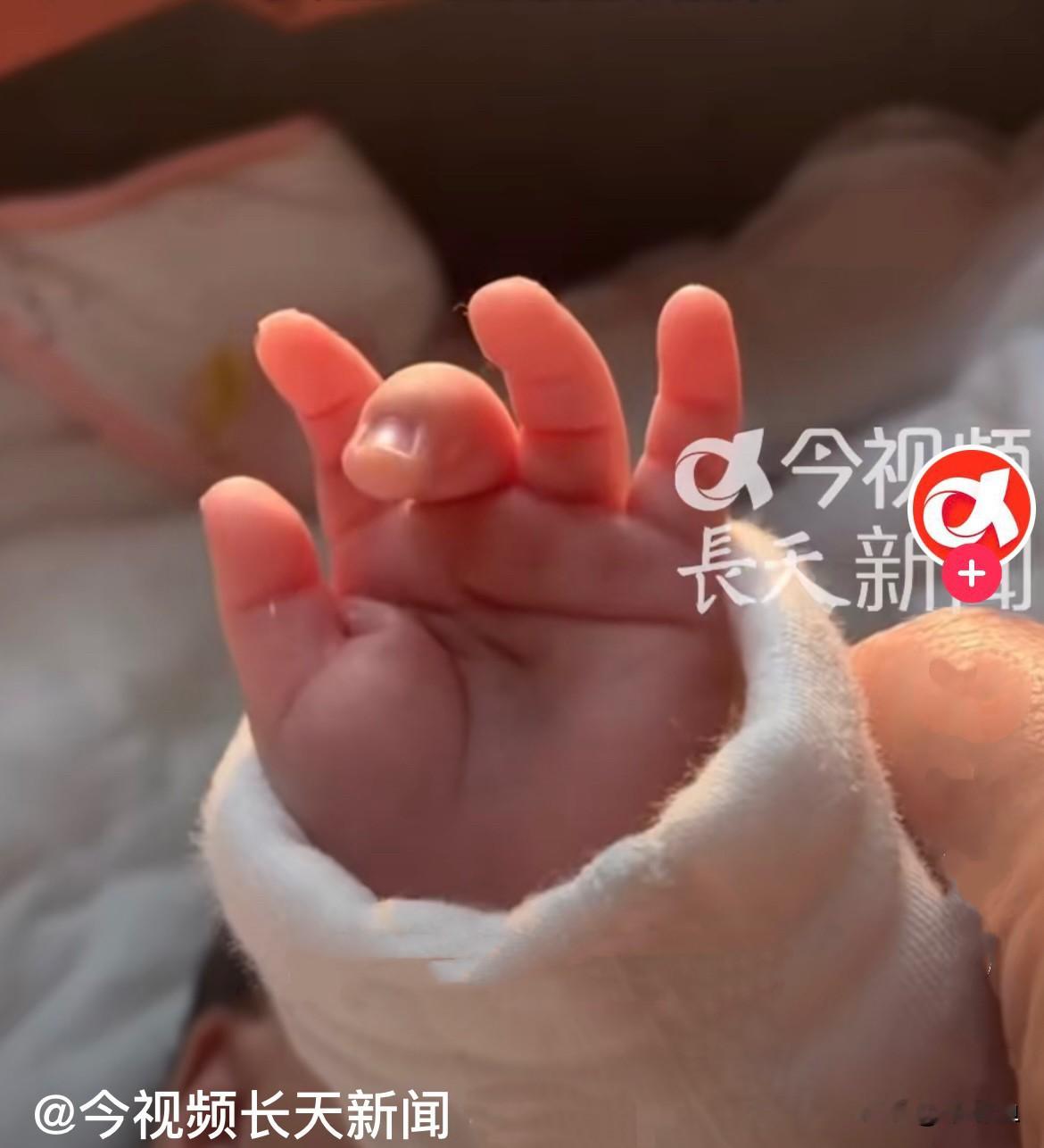 近日，广东深圳发生了一件完全打破常规的真实案例……
         按正常常识父母有一方是 AB型血，孩子绝对不可能是O型，父母有一方是O型血，孩子绝对不可能是AB型……
        广东深圳的王先生是 AB型血，妻子是A型血，妻子顺利生下可爱的女儿，结果一查血型：孩子是O型血，当时王先生直接