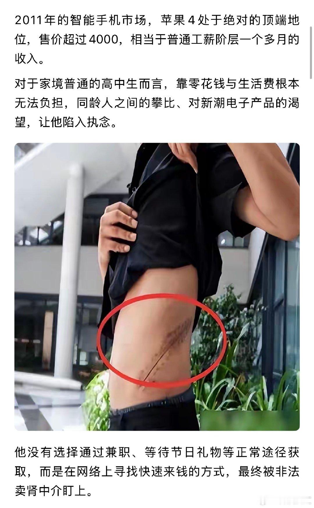 #父子因iPhone争执坠崖母亲也跳下# 
比当年卖肺买iPhone的国人更猛一些！
[捂嘴哭][捂嘴哭][捂嘴哭] ​