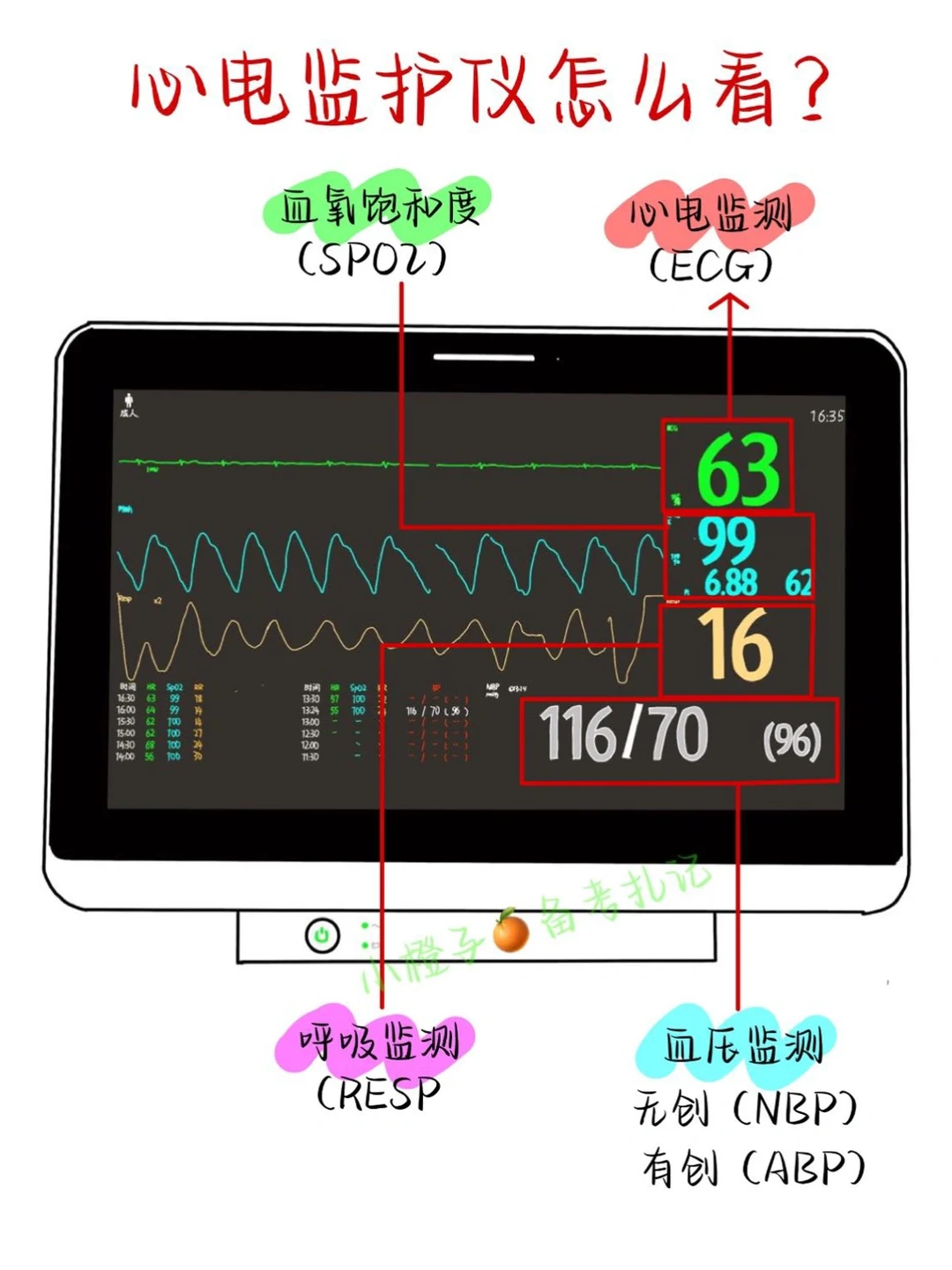 📖实习必备｜心电监护仪怎么看❓❓❓