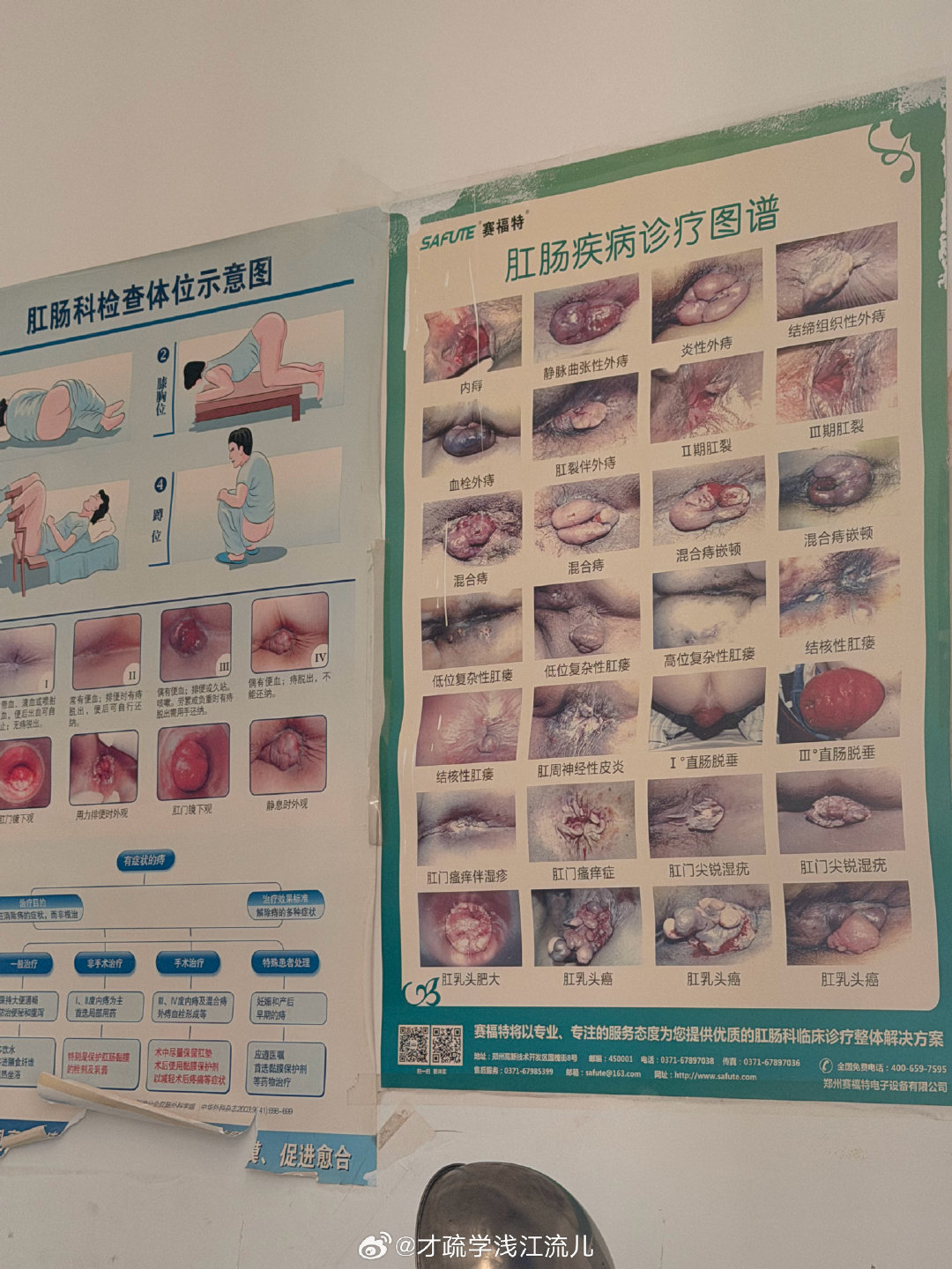慎点大图，在医院看到的科普图，大家可以对照一下。 ​