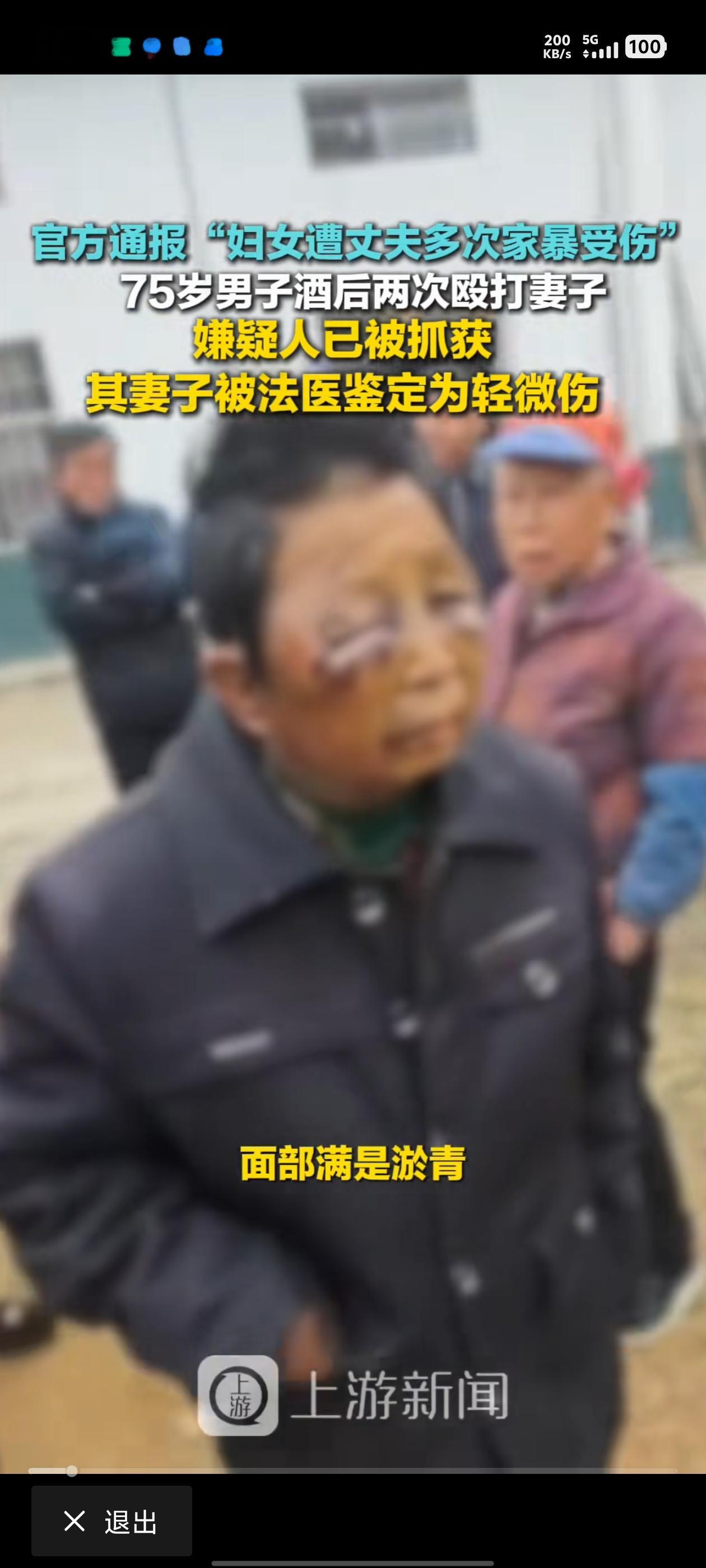 湖南平江县75男子酒后两次殴打妻子，嫌疑人已被抓，妻子满脸都是淤青，耳...