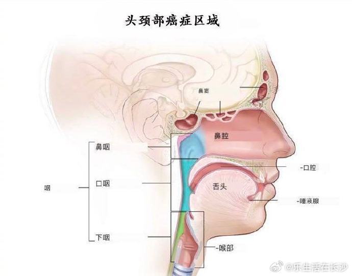 【口腔溃疡超过3周警惕头颈癌】头颈癌是一种涉及头面部和颈部区域的肿瘤...