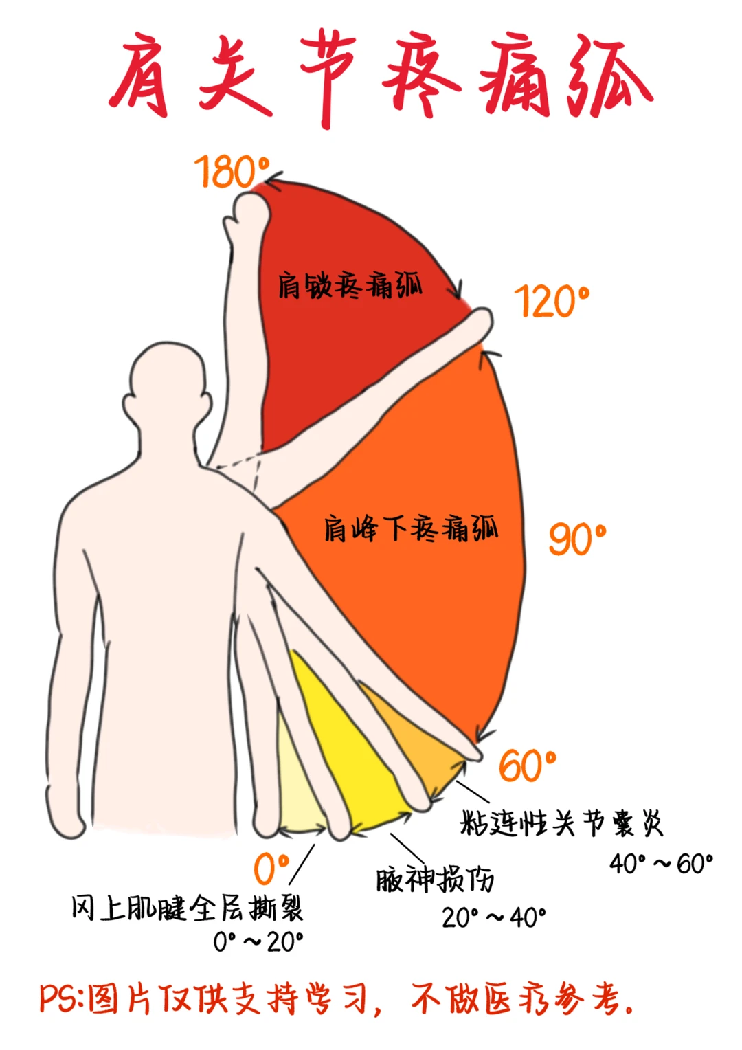 医学生笔记——肩关节疼痛弧