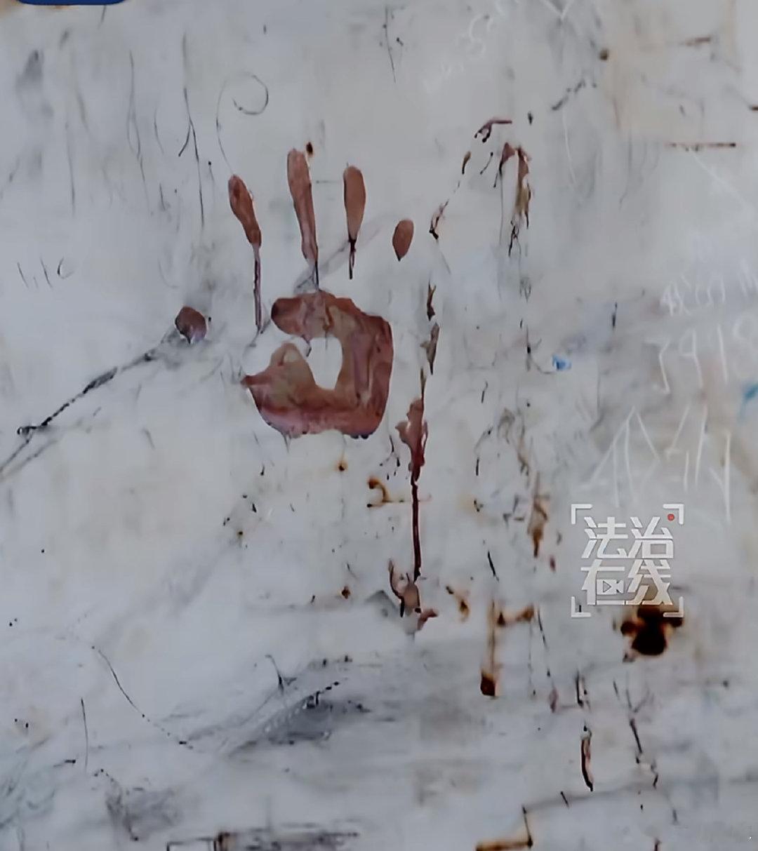 #男子无电诈业绩被打割腕自杀#
园区环境恶劣，吃喝拉撒都在一屋，没业绩就挨打，活生生被逼到绝路。真的盼着电诈彻底消失。 ​