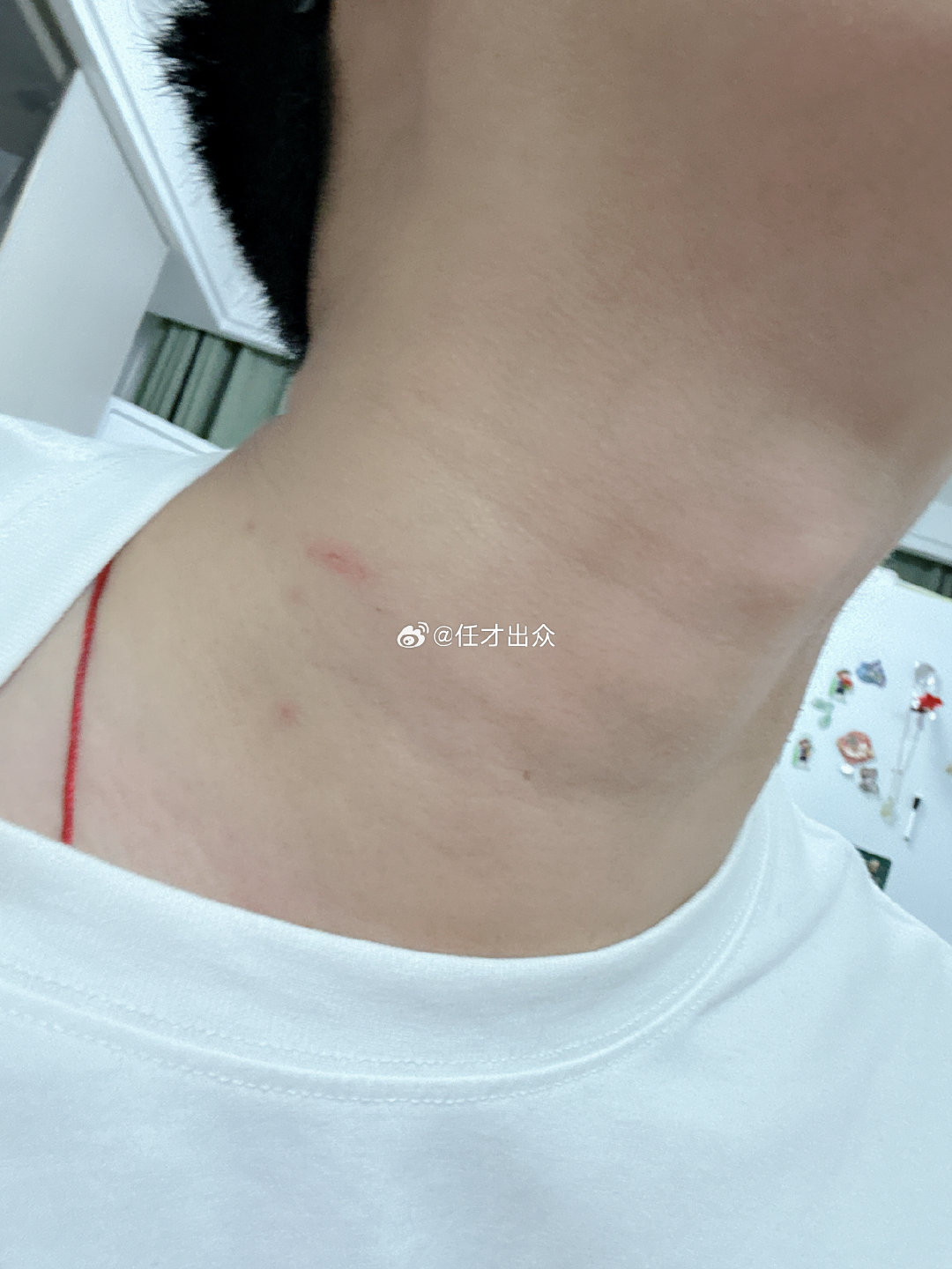 被大儿家暴了🤷🏻‍♂️🤷🏻‍♂️ ​