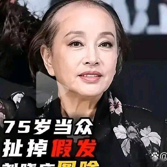 《刘晓庆摘假发后那句狠话，直接把内娱的虚伪撕开了》刘晓庆这种人，最适合放在娱乐圈里当标本，因为她不是那种靠一张嘴讲人设的明星，她是靠活法来拆人设的。 ​