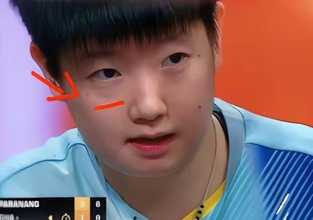 ​孙颖莎的面相真的不一样了，仔细看就能发现，现在她的精神状态真的太差了仔细看她的眼睛，以前都是亮晶晶的，现在已经一点儿光的都没有，而是就连眼下的眼袋也越来越重
​​今年八月WTT官方宣布孙颖莎退出欧洲大满贯瑞典站，俱乐部确认她存在长期高强度比赛累积形成的多处慢性劳损，正在进行系统性康 ​