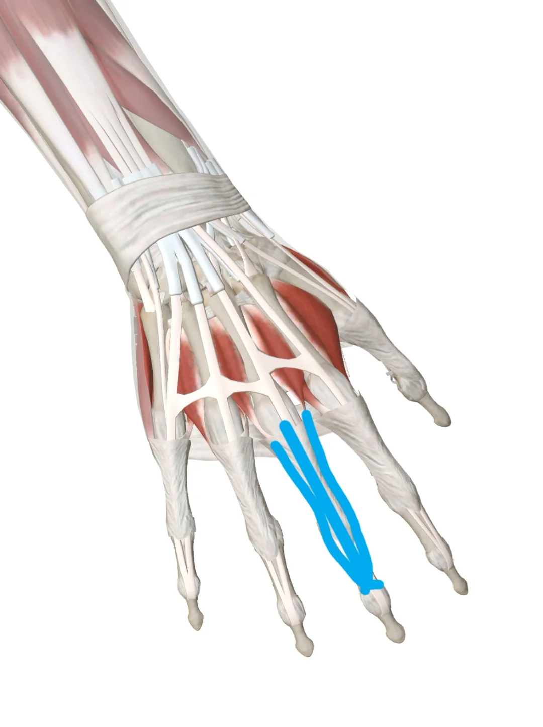 手指弯曲和伸展疼痛的人，如果这种疼痛在手腕弯曲或者伸展时有变化，则说明和跨关节的