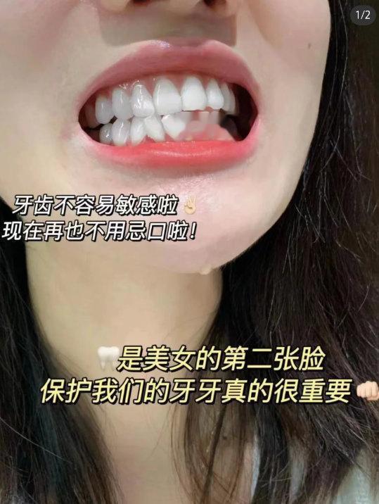 现在拍下还有加赠，赠完即止！  33.9元💰冷酸灵.泵式牙膏10件套...