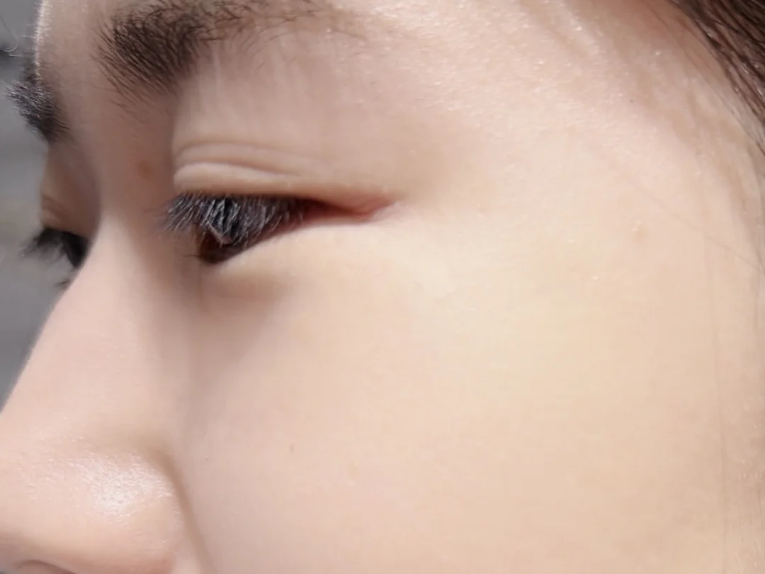 强推一个缩毛孔1000%的方法