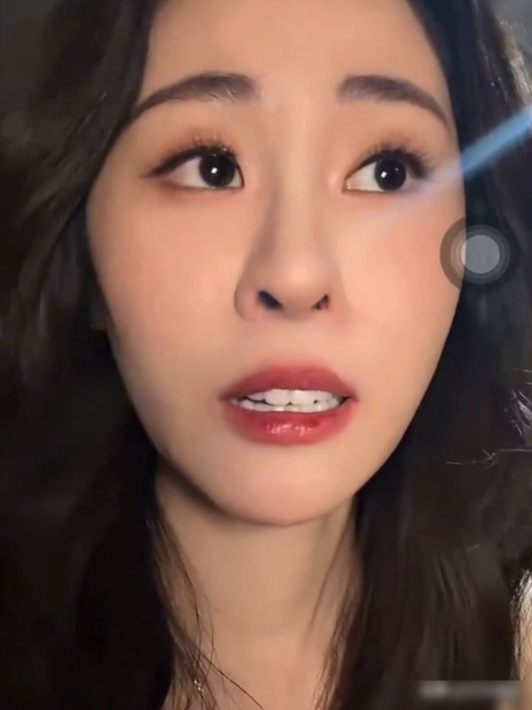 张碧晨脸上突然长出俩酒窝，她自己都懵了。
直播里她说，第一个酒窝是录《天赐的声音》那天早上冒出来的。化妆师一照镜子，右边脸颊多了个坑。一个多月后，左边也跟着长出来，凑齐了。
网友赶紧翻旧照，以前的她脸上光溜溜的，根本没有这玩意儿。成年人了还能凭空长酒窝？有人分析是皮下脂肪薄了，肌肉走向变了。管它