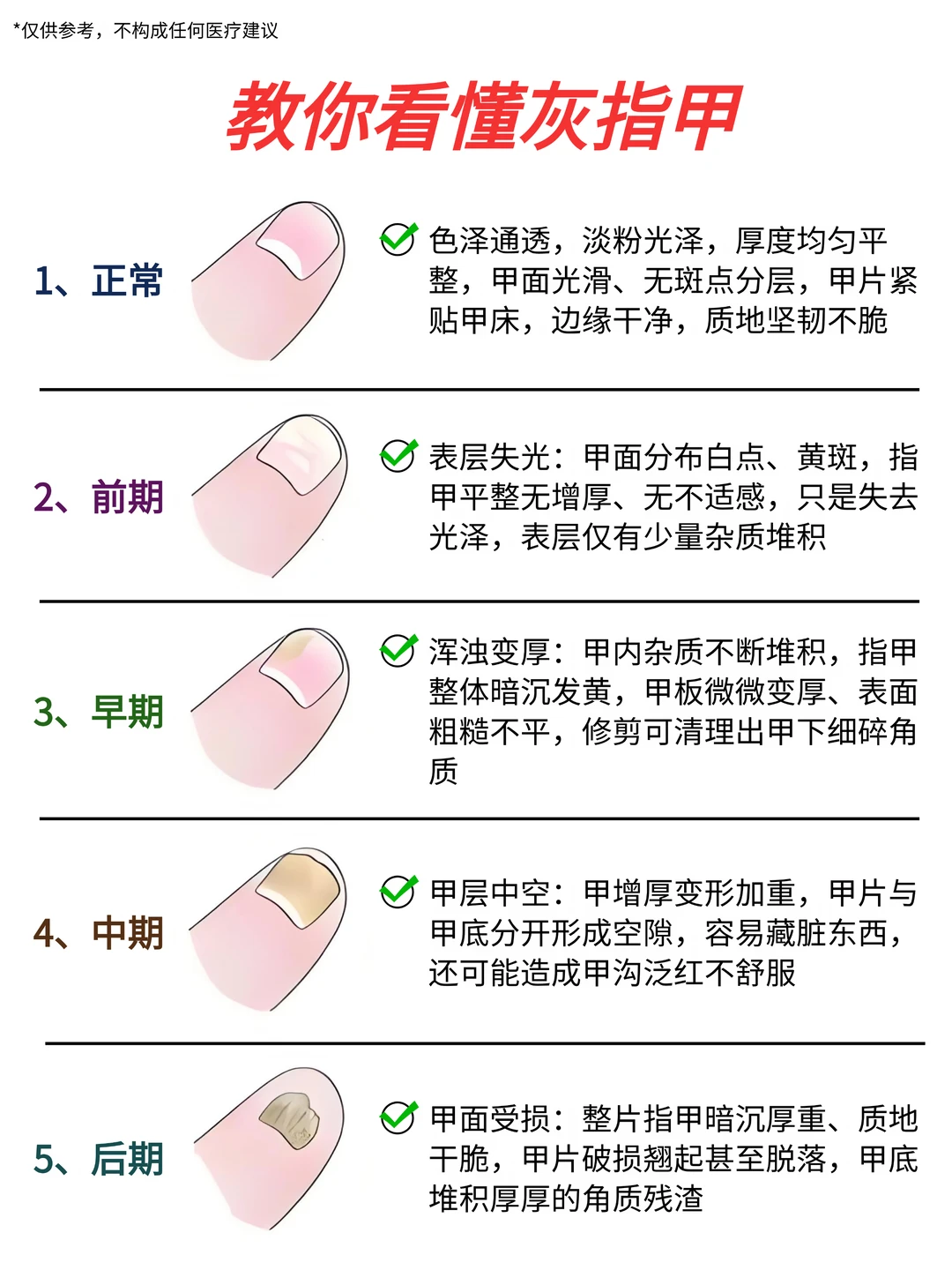 指甲悄悄变灰变黄❓4个阶段对照自查……
