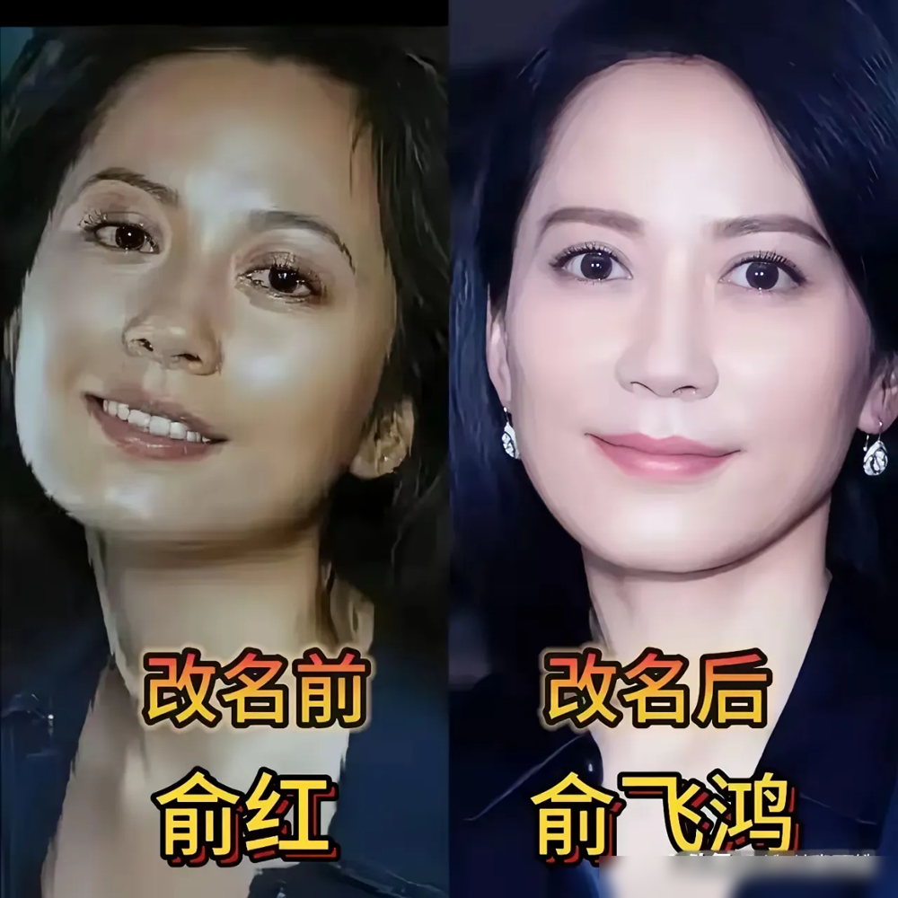 王鸥出道旧照流出，整没整容一眼看穿！
2003年CCTV模特大赛旧照里，她身高比一众超模偏矮，早年皮肤偏黑脸型偏圆，但五官轮廓早在当年就被夸全场最出众。
和现在的状态对比，五官根本没有结构性变化，所谓整容传闻全是误读。她从当年的清纯稚嫩，慢慢磨成了现在冷艳独立的御姐感，变的是妆容和阅历，不是天生