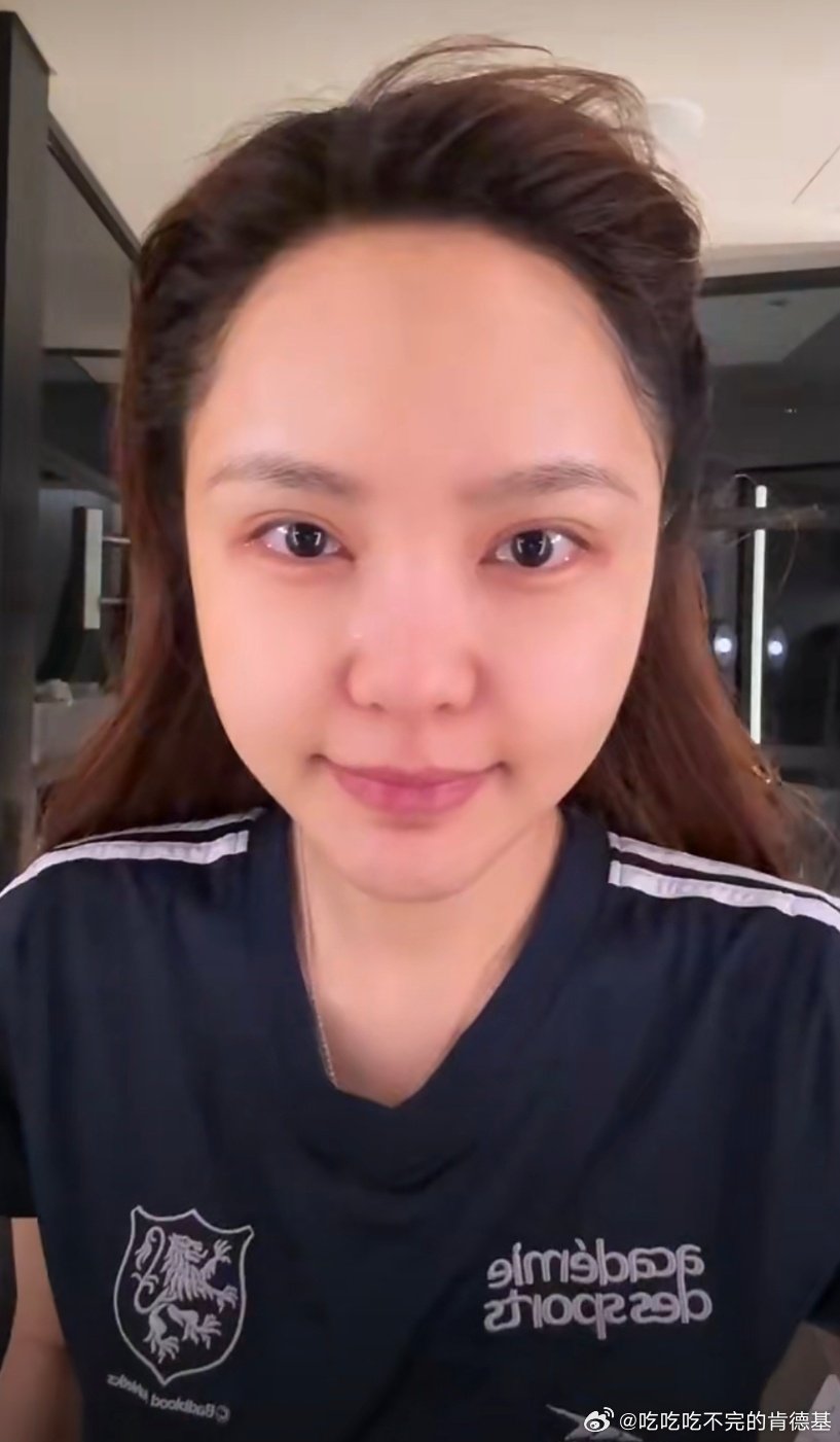 #周扬青自曝脸馒化了#互联网还有这姐在乎的人吗 ​