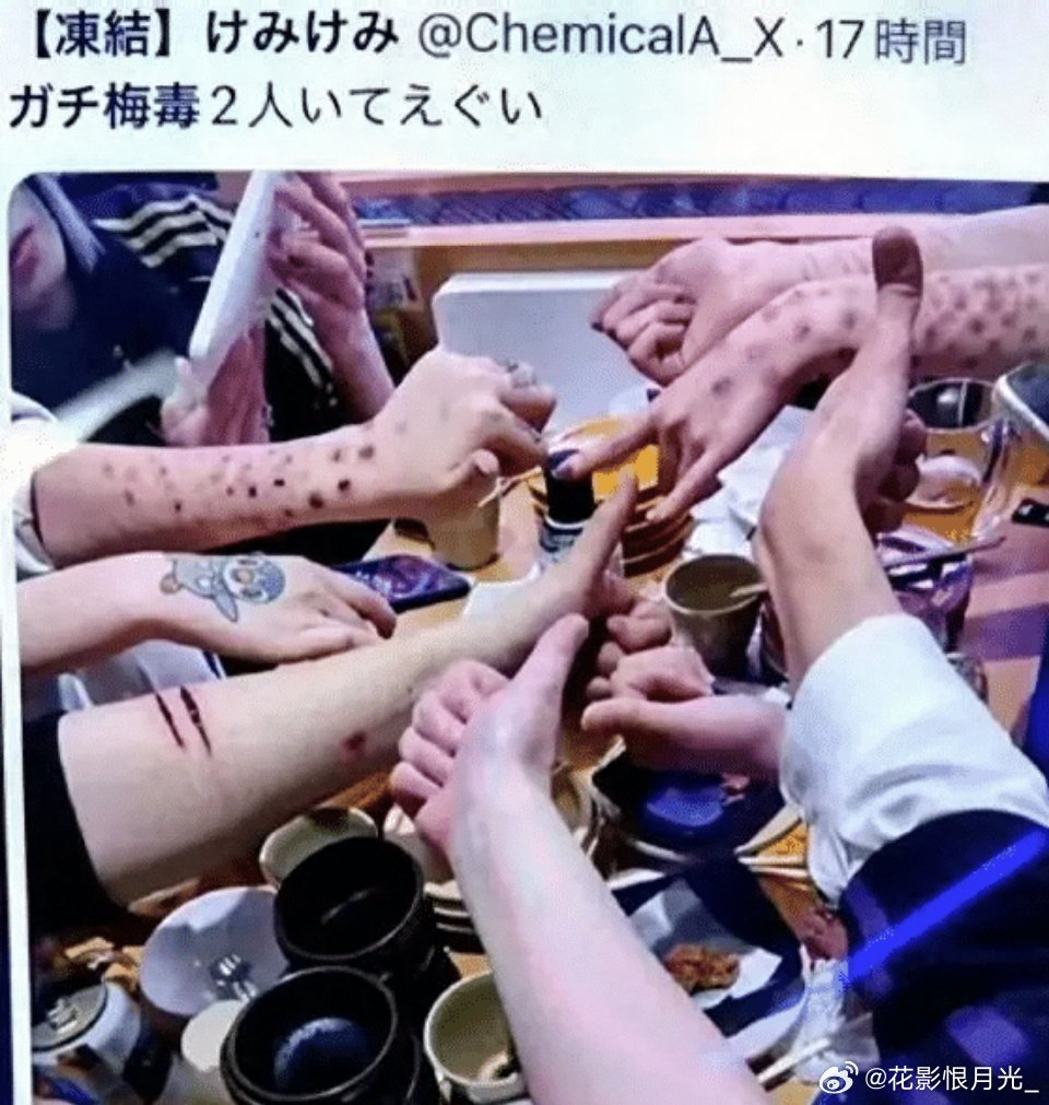#日本梅毒男性20到60岁女性20左右#

日本是梅毒历史死亡人数最多的国家，梅毒泛
滥根植于延续千年的社会民俗、畸形的风俗产
业以及长期缺位的公共卫生管控。

日本古代社会两性交往原始松散，平安时代大
规模效仿唐制推行大化改新，也没有吸收中式
婚恋忠贞和一夫一妻的严格约束。

男女比例和年龄段差 ​