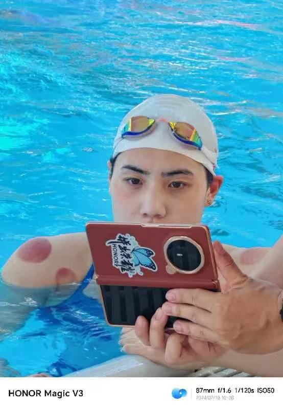 中国游泳队身上全是火罐印