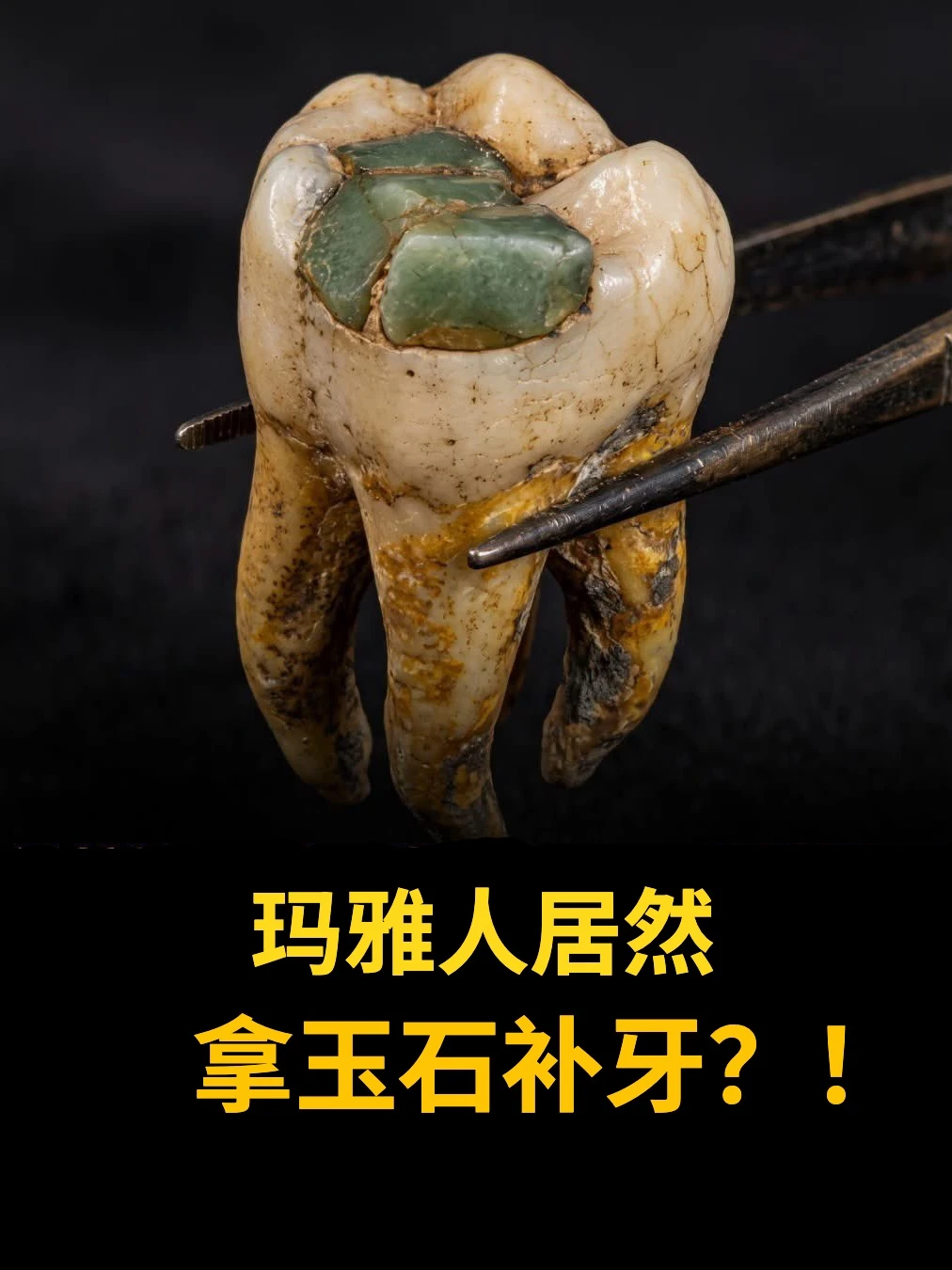 玛雅人居然拿玉石补牙？！