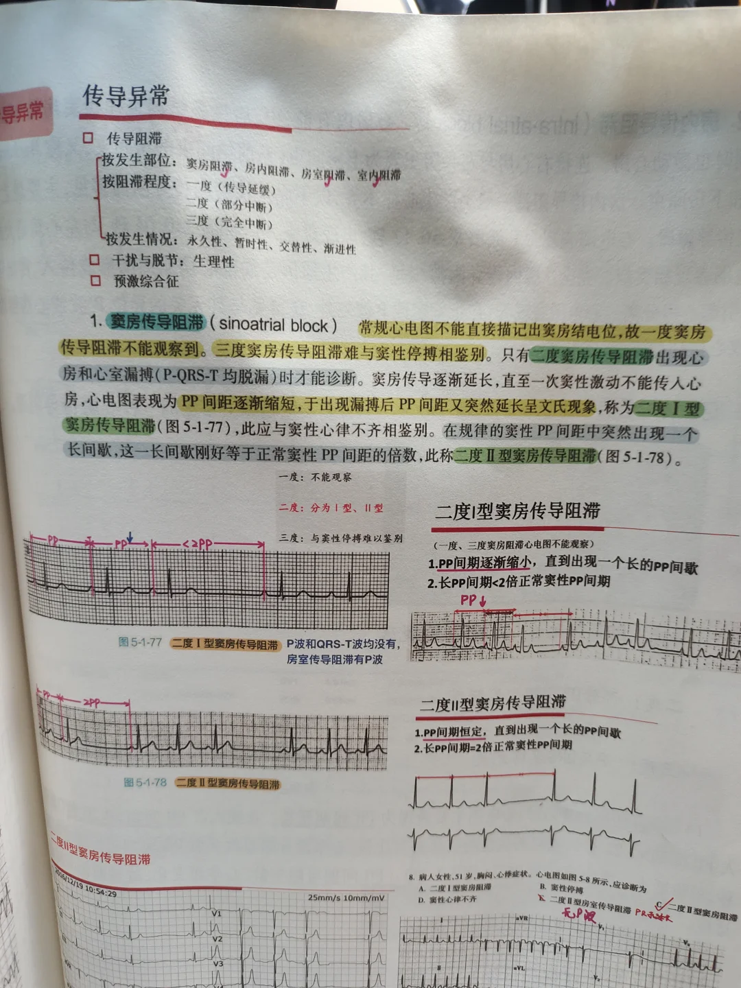 心电图夜班值班干货