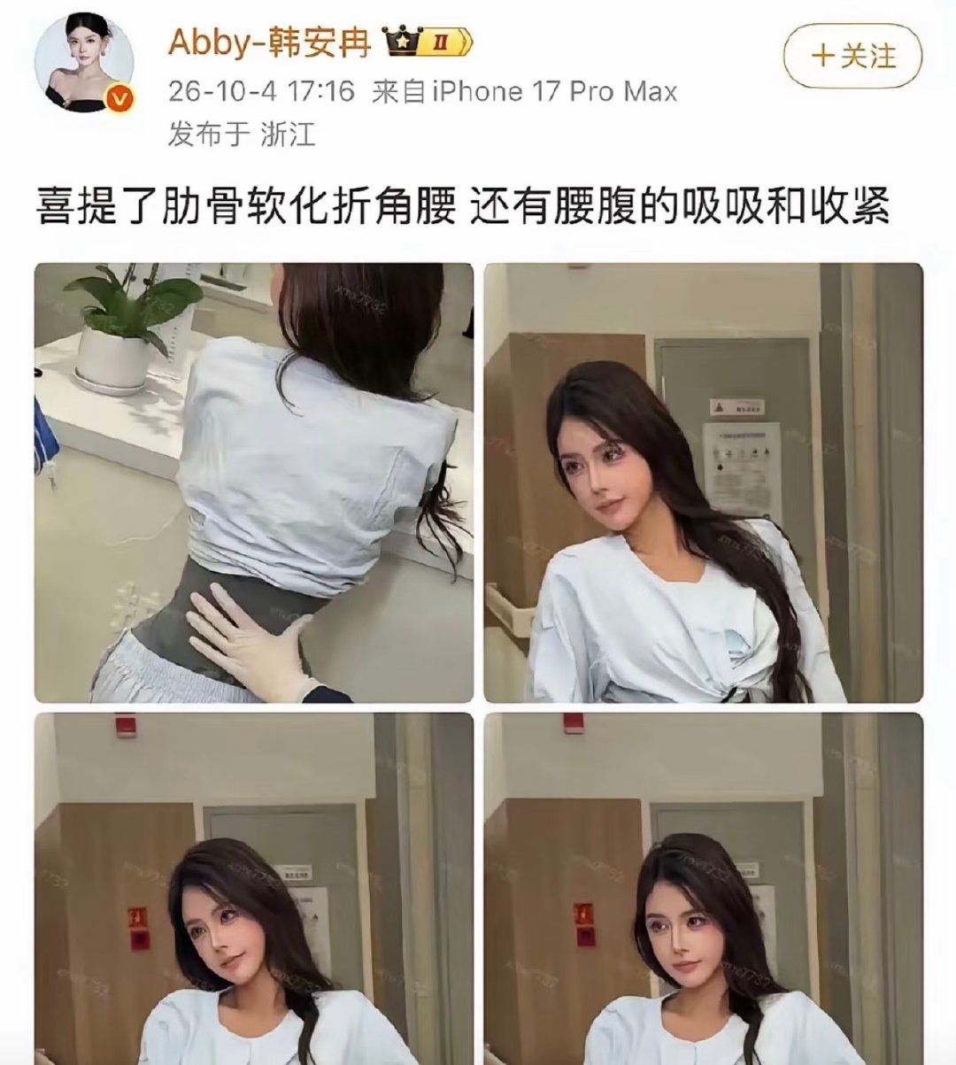 #韩安冉 极端医美# 刷到有网友分享对韩安冉医美的看法，觉得这样的医美有些过分，但也有网友觉得这是韩安冉自己的决定，她也拥有医美自由。 ​