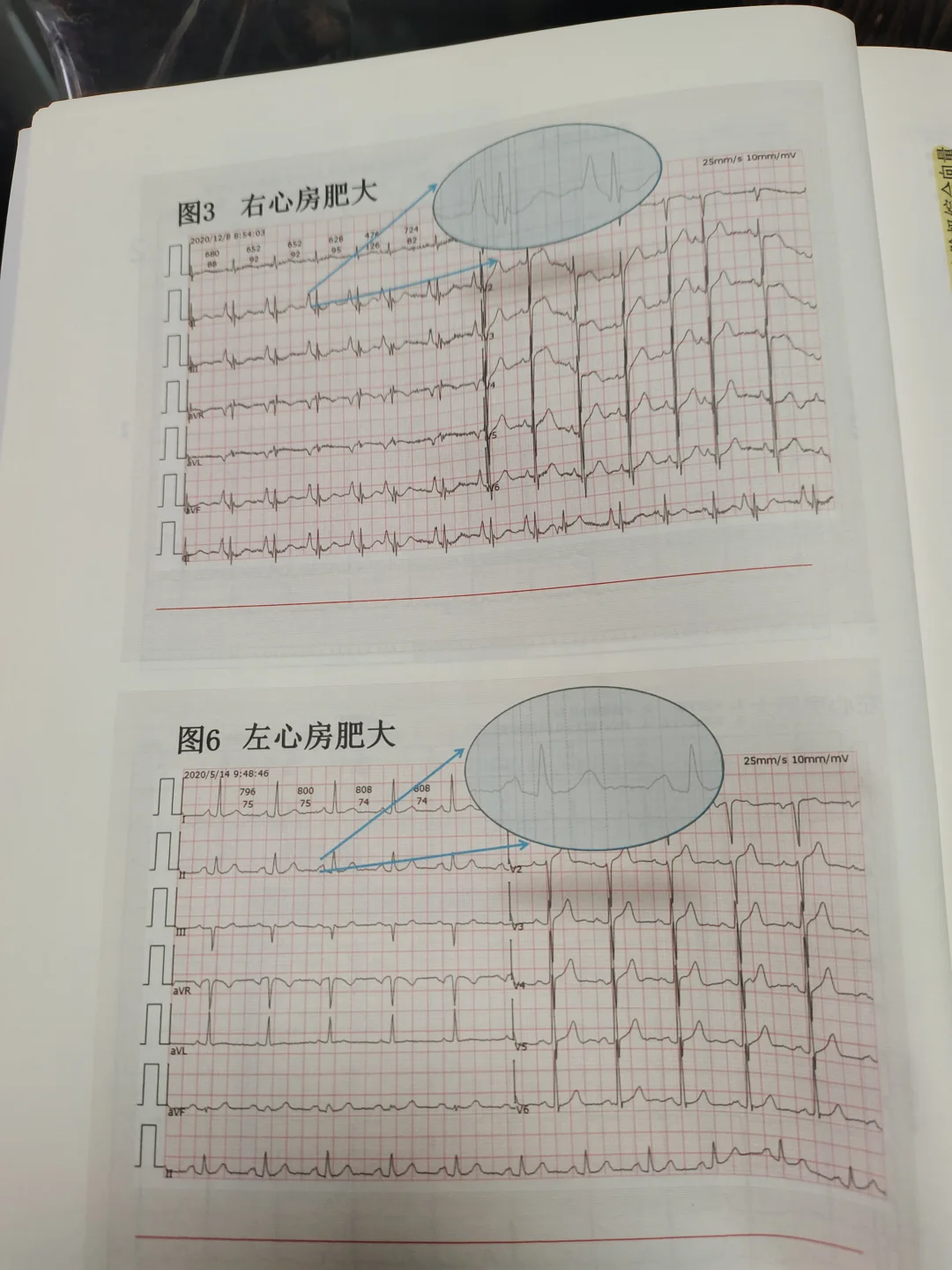 心电图夜班笔记本