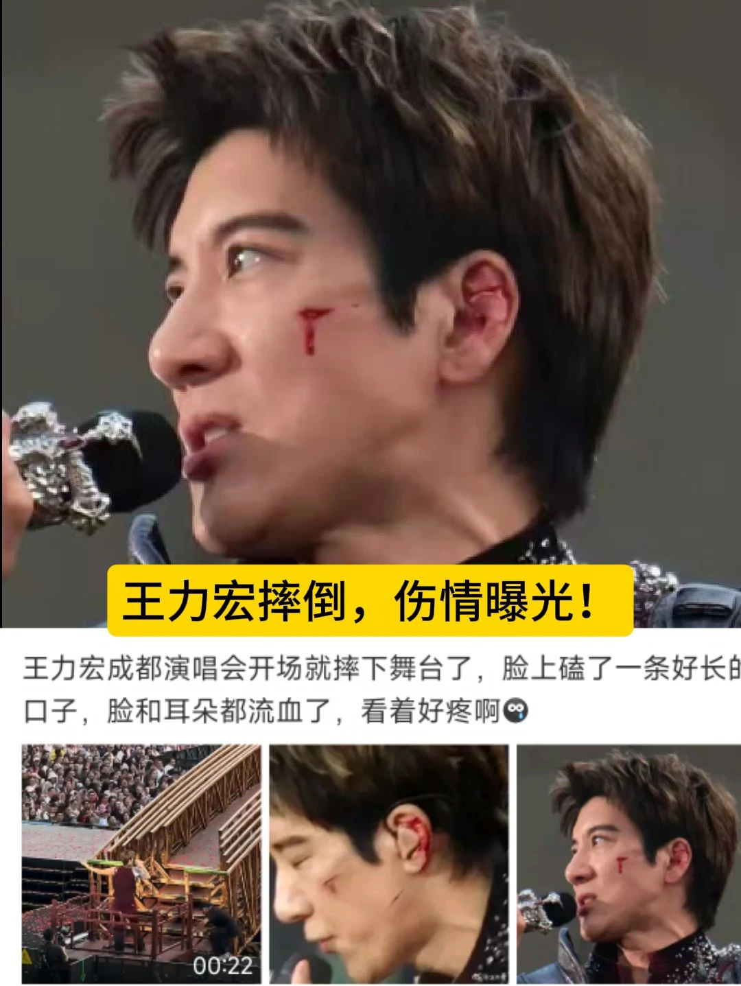 王力宏摔倒，伤情曝光！