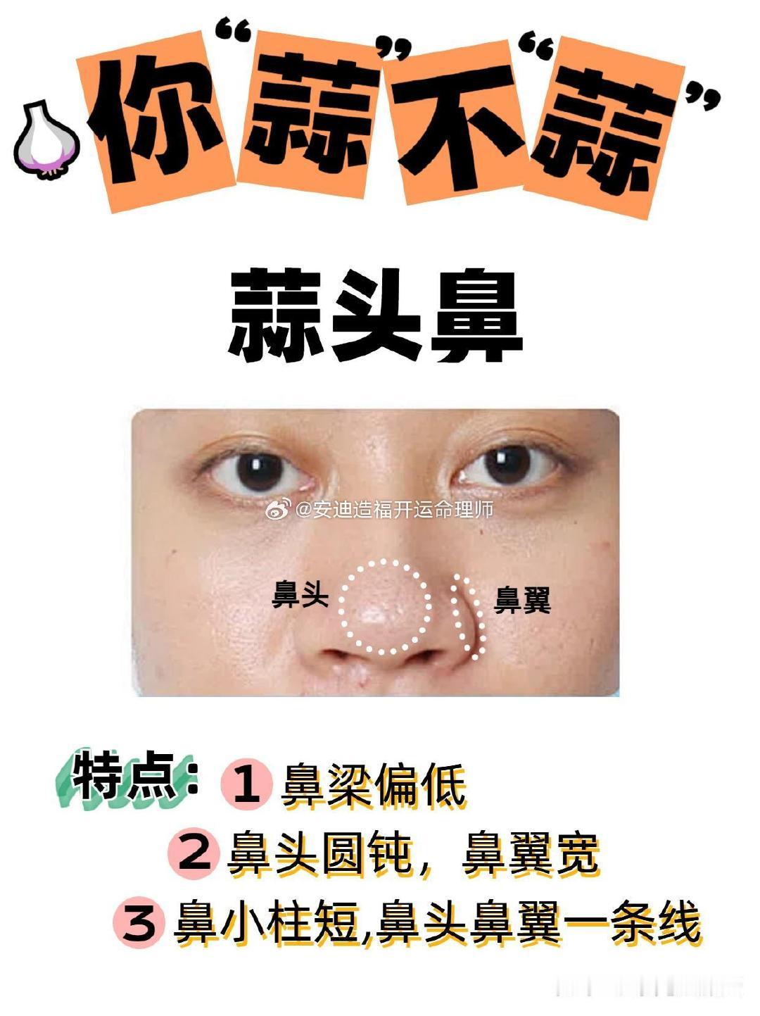 #女孩担心蒜头鼻遗传提分手#
蒜头鼻的男性多不拘小节、乐天；女性鼻翼分开角度过大被认为愚钝（实在），但鼻大丰隆则勤俭能吃苦 。‌‌ ​