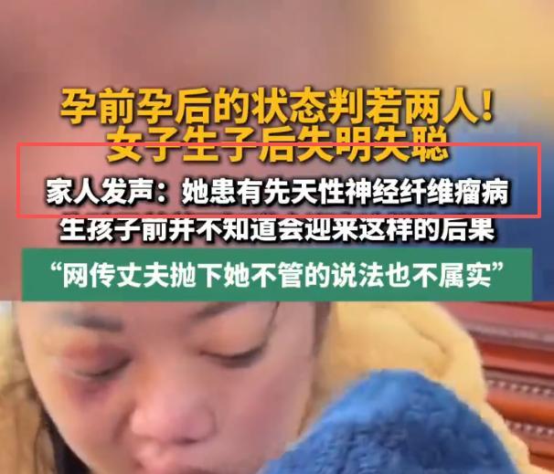 #三甲医生回应女子生娃后失明失聪#  明明是因为先天疾病导致，一推媒体硬是把锅扣给生育，搞了一堆新闻。这样的饱和式宣传下，生育氛围怎么会好呢？[摊手]所以，我说媒体机构应该减去三分之一，应该设置淘汰制和黑名单制，不然真的是“信马由缰”，什么流量大就乱带节奏，真不好。

→  ​