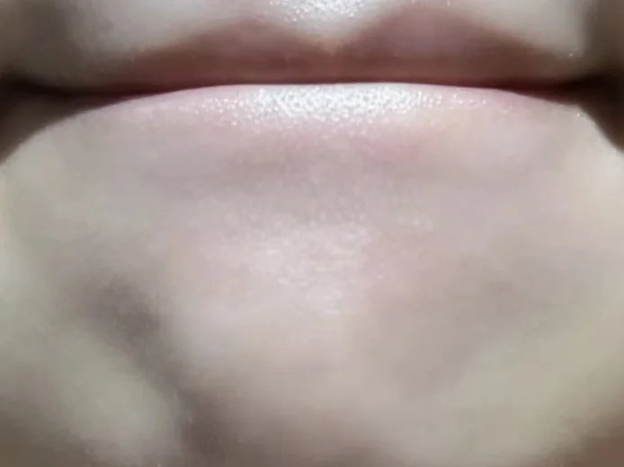 韩国🇰🇷明洞买的，祛痘印好猛啊啊啊