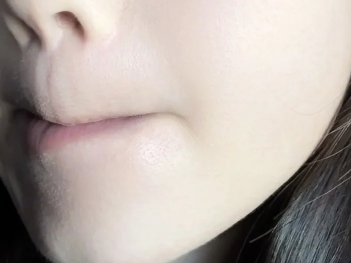 强推一个韩国的痘痕褪色剂