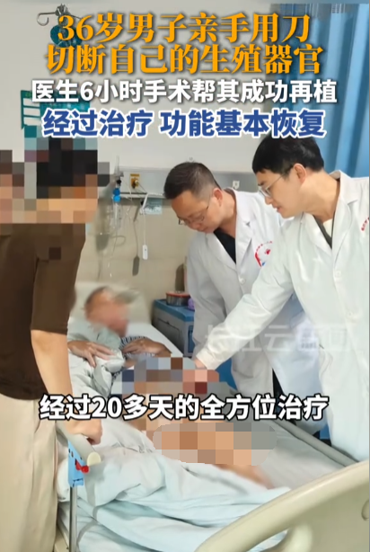湖南湘南，一名 36 岁抑郁症患者因情绪失控自伤，造成生殖器完全离断，家属紧急送医抢救。经过 6 小时显微再植手术，患者术后夜间生理性勃起功能基本恢复，可自主排尿。
 
这类极端自伤案例警示大家重视精神疾病长期管理，很多人觉得这只是个别现象，但在我看来，这背后折射出的恰恰是精神疾病患者在漫长治疗周期