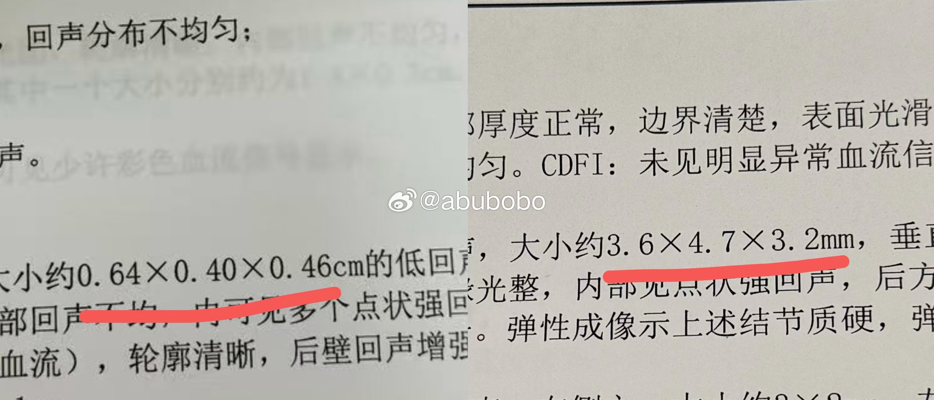 来自一个早已调整过住宅格局的弟子反馈。问题源于1.家中不合适位置摆放太多照片；2.照片中有多张白色西装白色婚纱的结婚照（白色主丧，就是不吉！）；3.放着好好的主卧不睡，擅自搬到格局差的卧室、与家中小狗同居。原本健康的人，体检突发甲状腺四级结节（恶性概率偏大）。重新调整格局3日后复查，结节已缩小近一半。这就是玄学！玄学