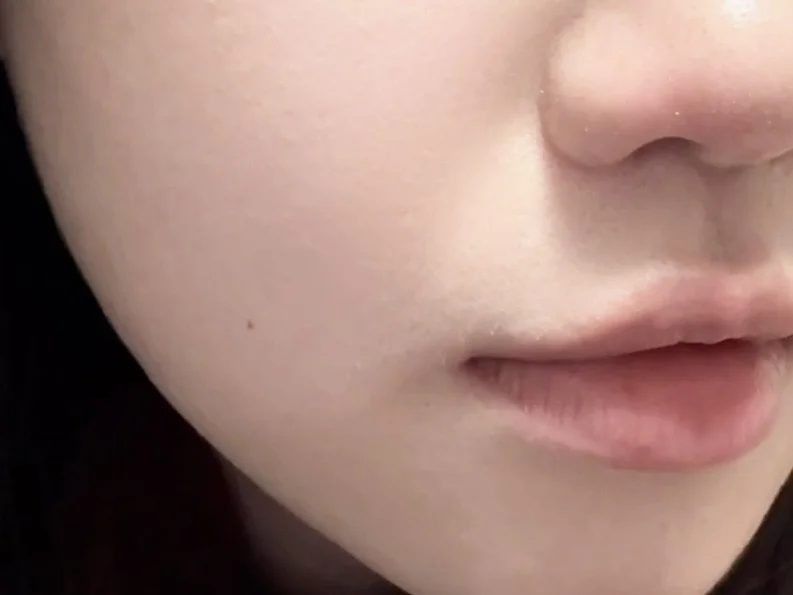 建议法令纹重的都去试试这个啊啊啊啊啊