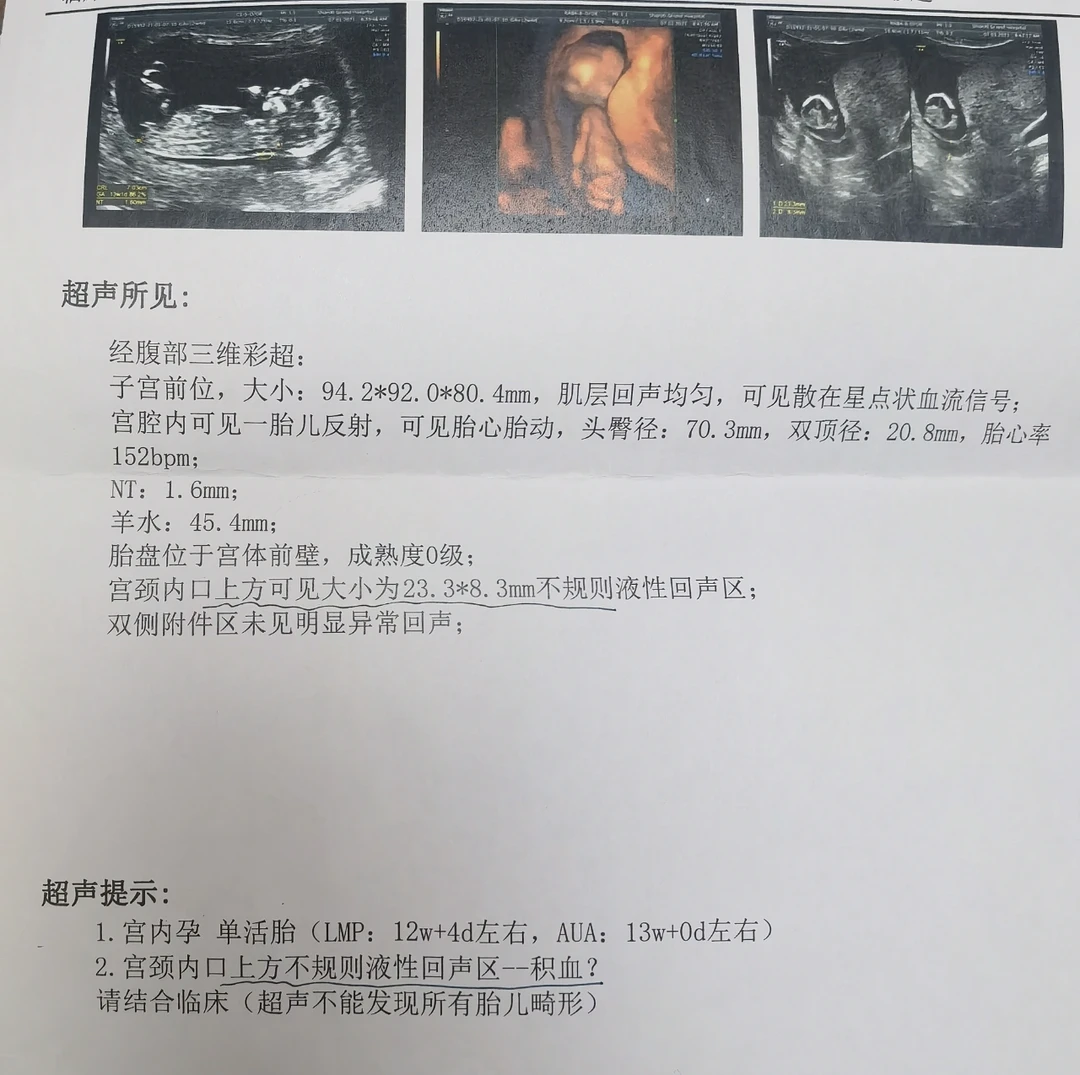 【孕12周】NT检查出现积血，医生告知没事？