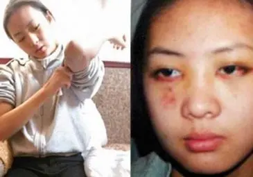 2003年12月16日，张国立的儿子张默在中戏门口和女友童瑶起了冲突，最后演变成殴打，童瑶被打到跪地求停，还说让他歇10分钟再打，她想缓一缓，结果对方没有停，伤害反而更重。

童瑶事后回忆，当天张默反复联系她，让她下楼见面沟通，她一开始不想闹大，还是被反复催着才出来，想把话说清楚。可一见面，两人就吵