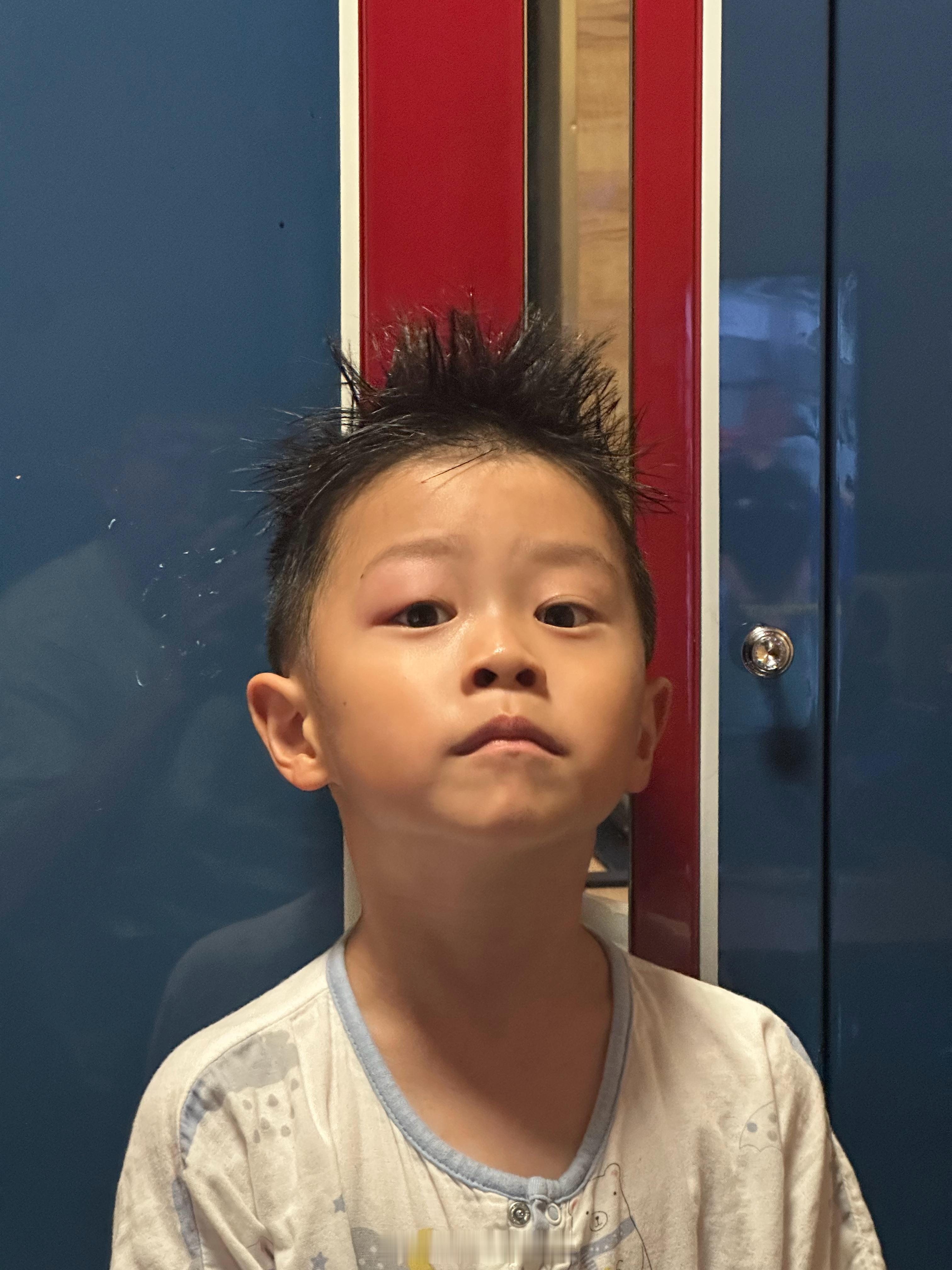 虽然被蚊子咬了但依旧铁骨铮铮 ​​​