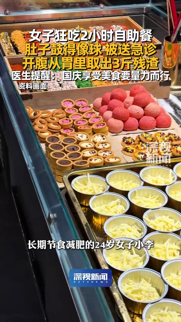 一顿自助餐，吃到开腹。

（信息来源：深视新闻，10月4日）

深圳，24岁的小李，长期节食减肥，把自助餐当成“放纵餐”。两个钟头里羊肉牛肉粉丝金针菇往嘴里塞，肚子鼓得像个球，吐不出来，也排不出去，最后是被人送进急诊的。

医生打开腹腔一看，胃里的食物残渣足足三斤。

注意，不是三斤食物，是三斤残渣